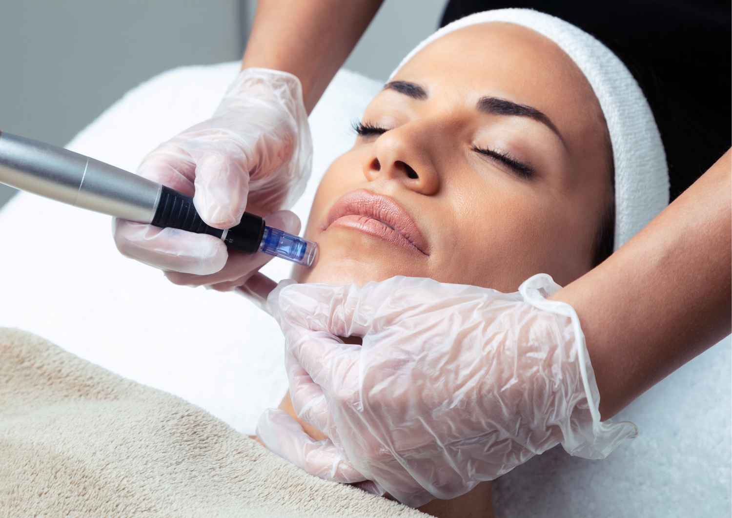 Dermapen (Microneedling)
